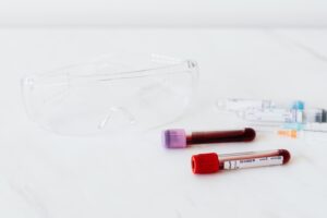 Blood test tubes for hormone panel — what labs you need before starting testosterone therapy
